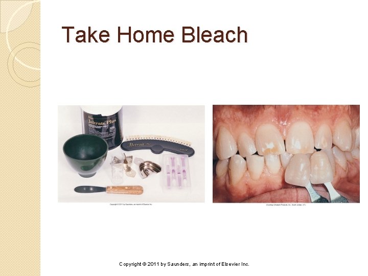 Take Home Bleach Copyright © 2011 by Saunders, an imprint of Elsevier Inc. 