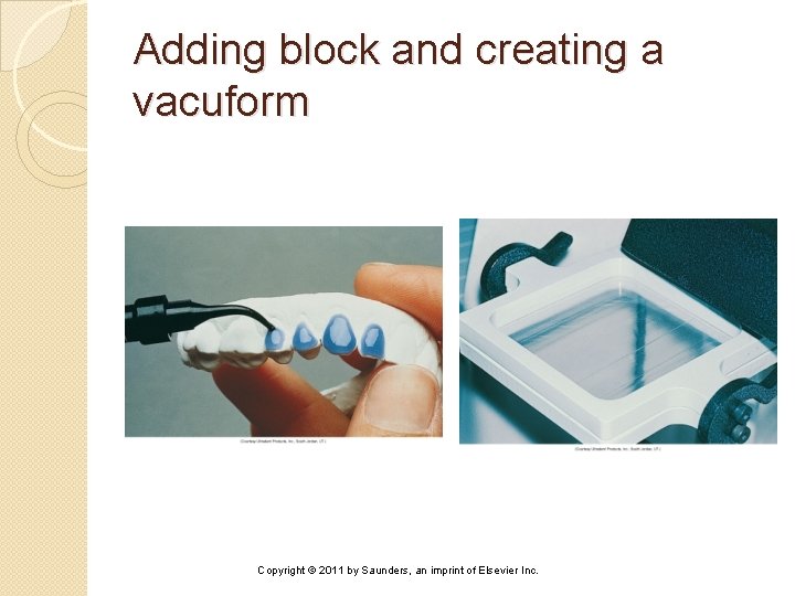 Adding block and creating a vacuform Copyright © 2011 by Saunders, an imprint of