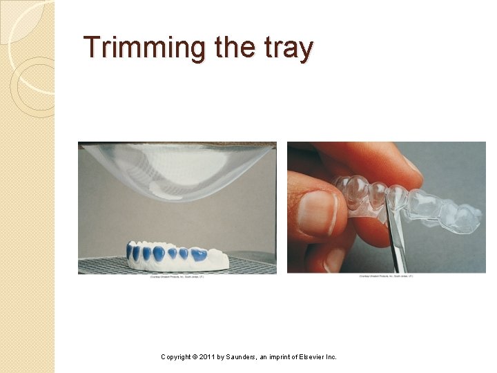 Trimming the tray Copyright © 2011 by Saunders, an imprint of Elsevier Inc. 