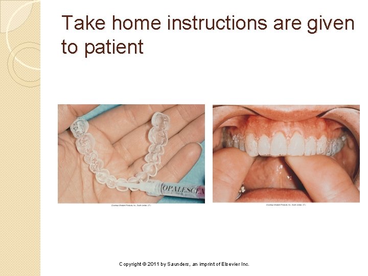 Take home instructions are given to patient Copyright © 2011 by Saunders, an imprint