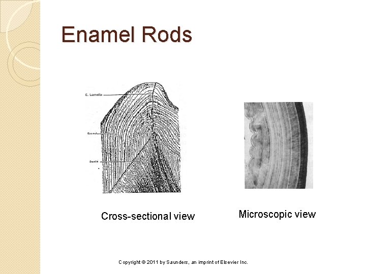 Enamel Rods Cross-sectional view Microscopic view Copyright © 2011 by Saunders, an imprint of