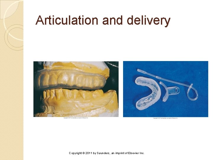 Articulation and delivery Copyright © 2011 by Saunders, an imprint of Elsevier Inc. 