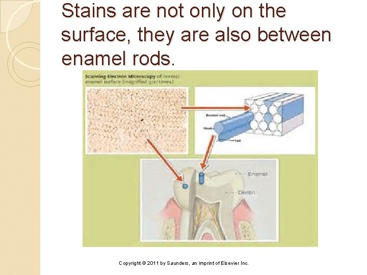 Stains are not only on the surface, they are also between enamel rods. Copyright