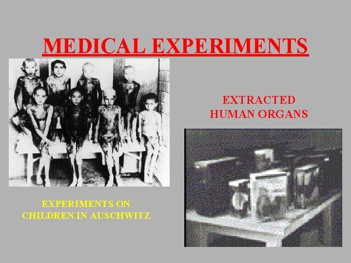 MEDICAL EXPERIMENTS EXTRACTED HUMAN ORGANS EXPERIMENTS ON CHILDREN IN AUSCHWITZ 