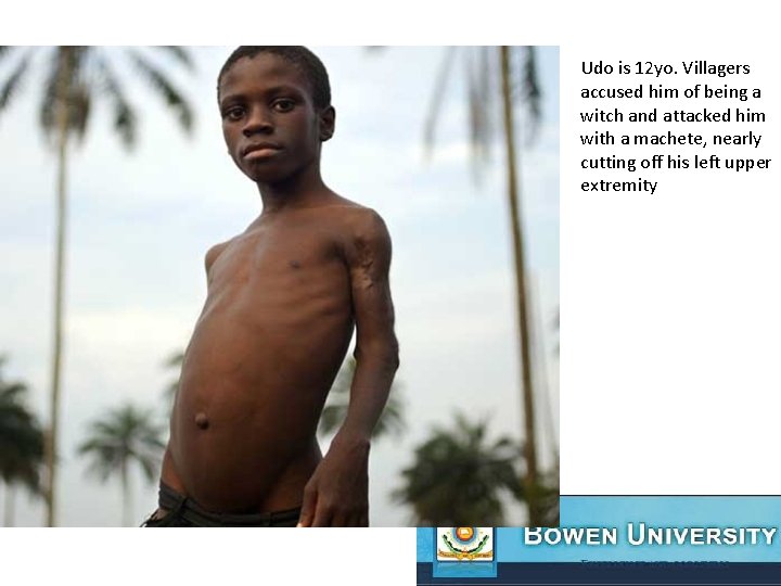 Udo is 12 yo. Villagers accused him of being a witch and attacked him