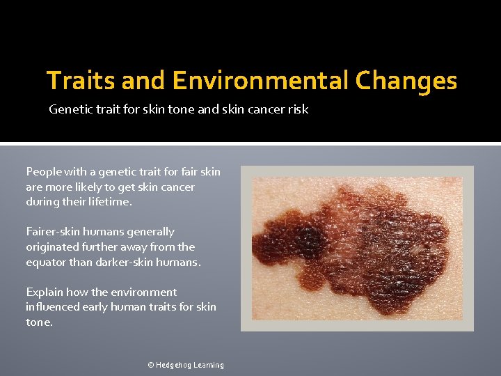 Traits and Environmental Changes Genetic trait for skin tone and skin cancer risk People