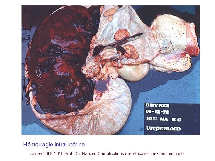 Hémorragie intra-utérine Année 2009 -2010 Prof. Ch. Hanzen Complications obstétricales chez les ruminants 