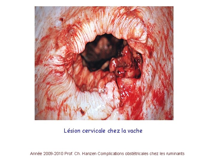 Lésion cervicale chez la vache Année 2009 -2010 Prof. Ch. Hanzen Complications obstétricales chez