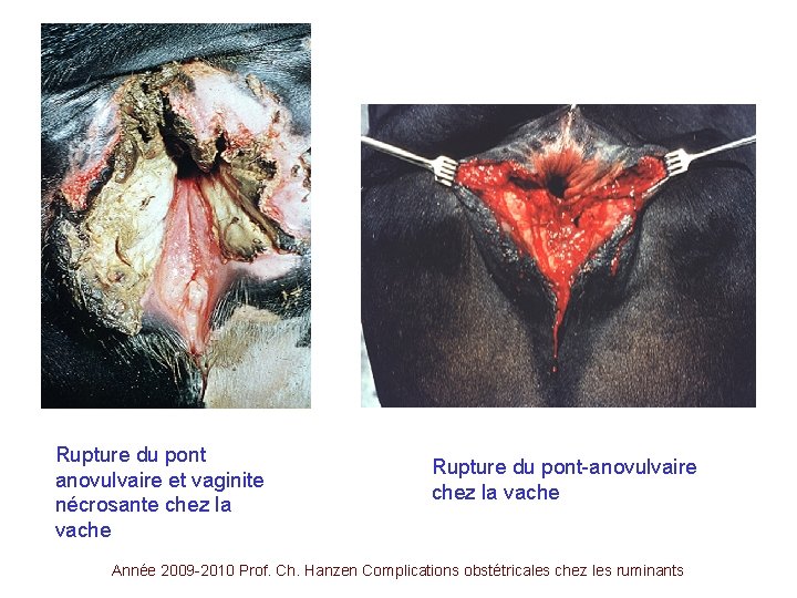 Rupture du pont anovulvaire et vaginite nécrosante chez la vache Rupture du pont-anovulvaire chez