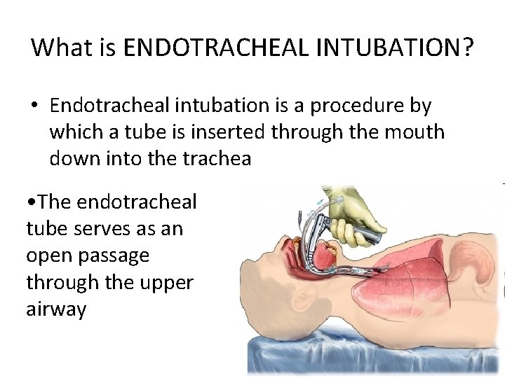 What is ENDOTRACHEAL INTUBATION? • Endotracheal intubation is a procedure by which a tube What is ENDOTRACHEAL INTUBATION? • Endotracheal intubation is a procedure by which a tube