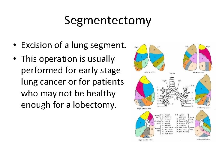 Segmentectomy • Excision of a lung segment. • This operation is usually performed for Segmentectomy • Excision of a lung segment. • This operation is usually performed for