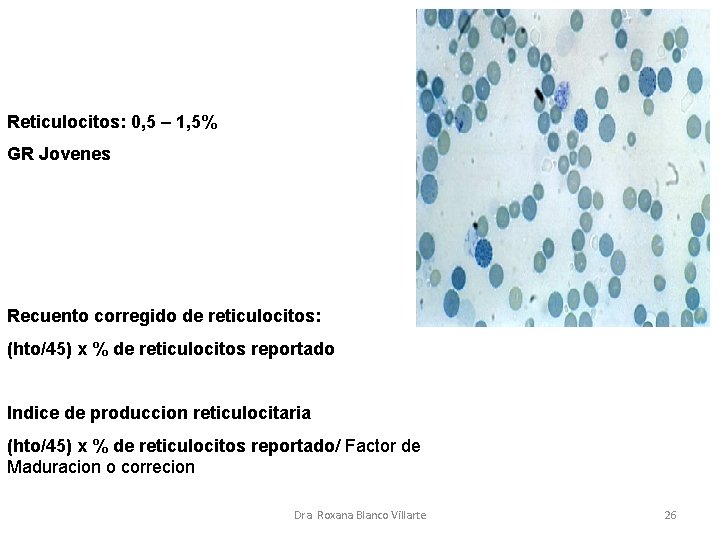 Reticulocitos: 0, 5 – 1, 5% GR Jovenes Recuento corregido de reticulocitos: (hto/45) x Reticulocitos: 0, 5 – 1, 5% GR Jovenes Recuento corregido de reticulocitos: (hto/45) x