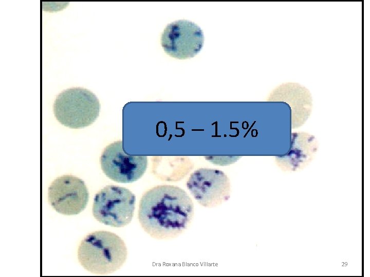 ANEMIA. CLASIFICACIÓN FUNCIONAL (POR RESPUESTA DE LA MÉDULA ÓSEA) REGENERATIVA: 0, 5 – 1. ANEMIA. CLASIFICACIÓN FUNCIONAL (POR RESPUESTA DE LA MÉDULA ÓSEA) REGENERATIVA: 0, 5 – 1.