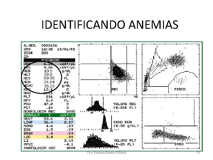 IDENTIFICANDO ANEMIAS Dra. Roxana Blanco Villarte 71 IDENTIFICANDO ANEMIAS Dra. Roxana Blanco Villarte 71