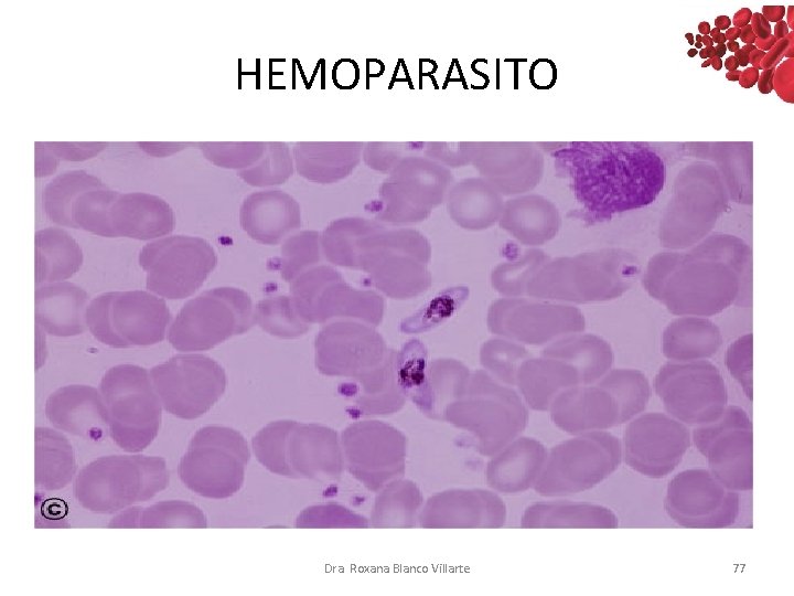 HEMOPARASITO Dra. Roxana Blanco Villarte 77 HEMOPARASITO Dra. Roxana Blanco Villarte 77