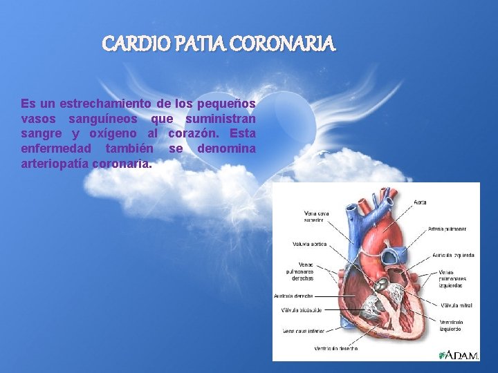 CARDIO PATIA CORONARIA Es un estrechamiento de los pequeños vasos sanguíneos que suministran sangre