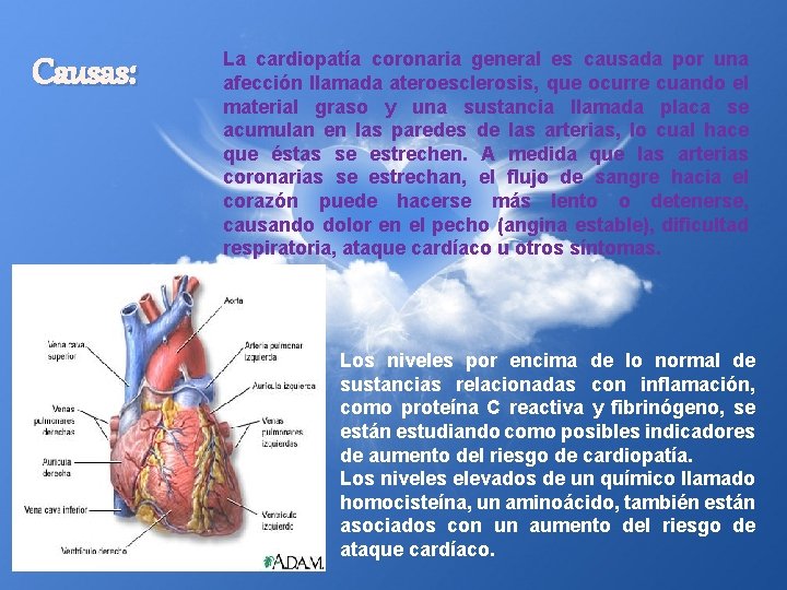 Causas: La cardiopatía coronaria general es causada por una afección llamada ateroesclerosis, que ocurre