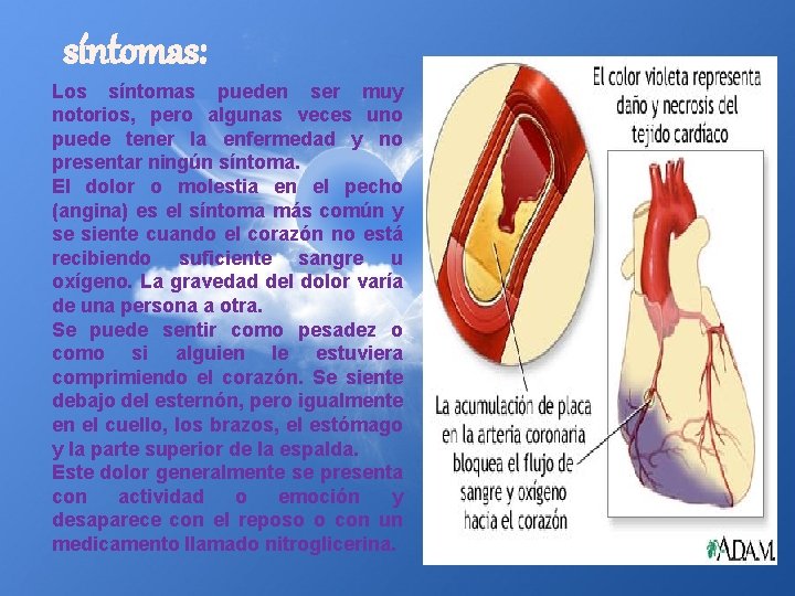 síntomas: Los síntomas pueden ser muy notorios, pero algunas veces uno puede tener la