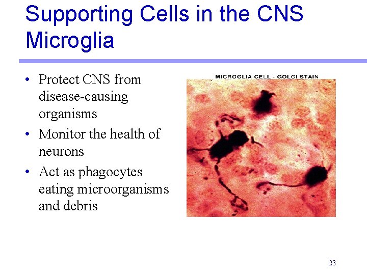 Supporting Cells in the CNS Microglia • Protect CNS from disease-causing organisms • Monitor