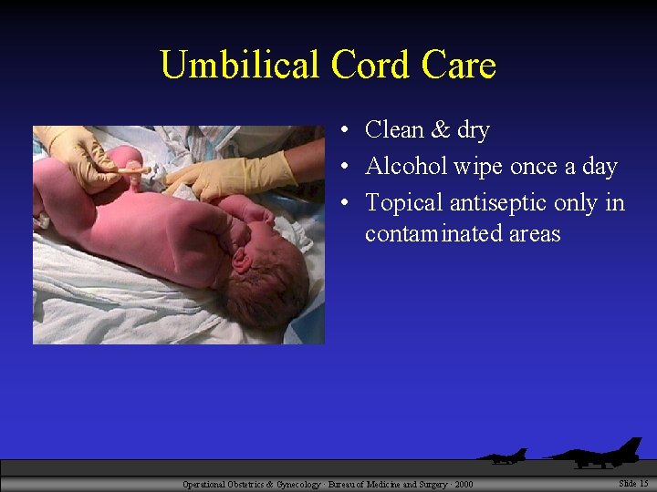 Umbilical Cord Care • Clean & dry • Alcohol wipe once a day •