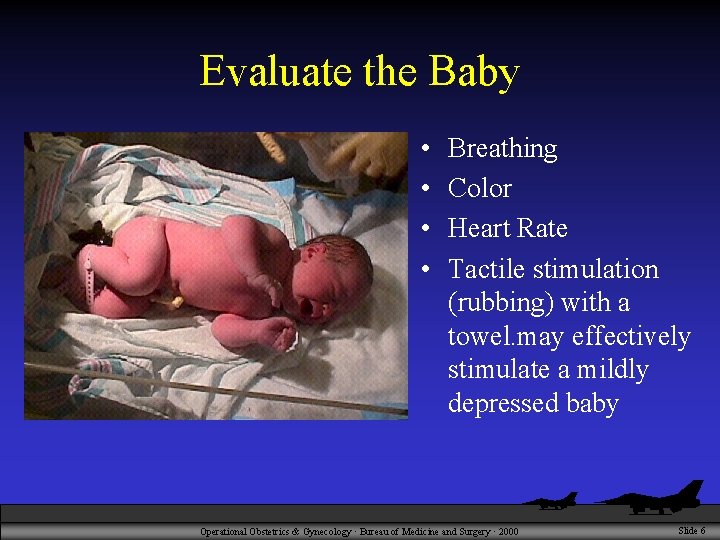 Evaluate the Baby • • Breathing Color Heart Rate Tactile stimulation (rubbing) with a