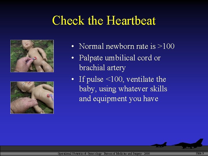Check the Heartbeat • Normal newborn rate is >100 • Palpate umbilical cord or
