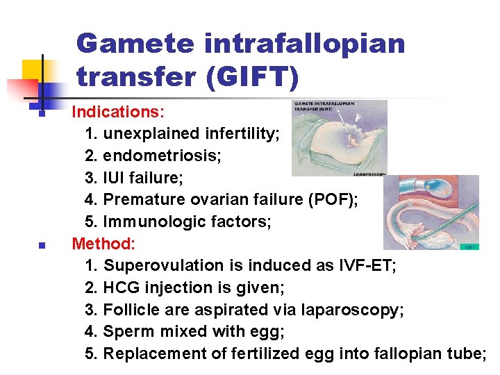 Gamete intrafallopian transfer (GIFT) n n Indications: 1. unexplained infertility; 2. endometriosis; 3. IUI