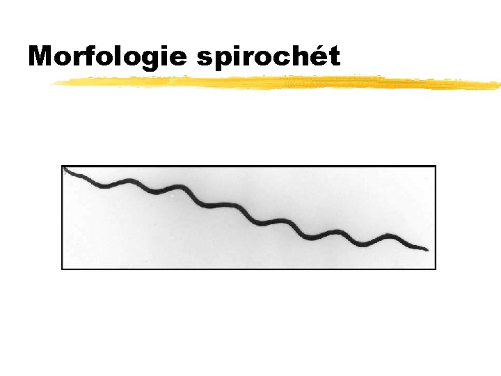 Morfologie spirochét 