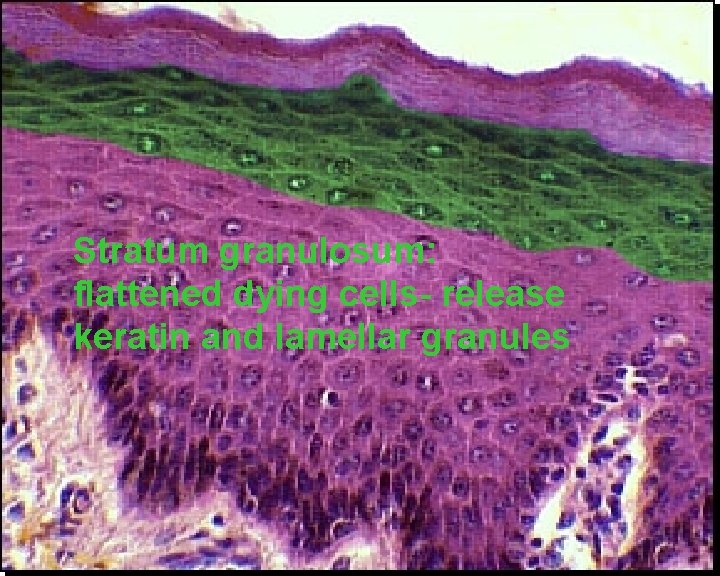 Stratum granulosum: flattened dying cells- release keratin and lamellar granules 