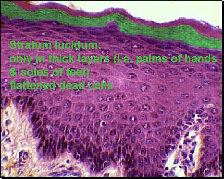Stratum lucidum: only in thick layers (i. e. palms of hands & soles of