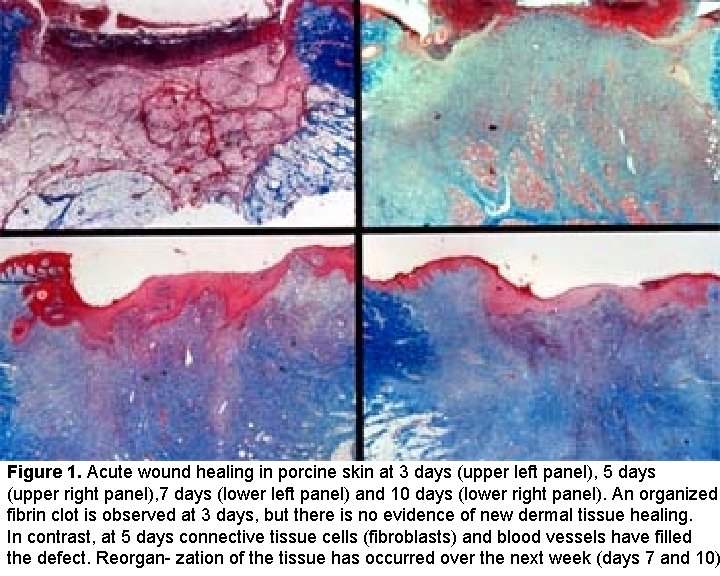 Figure 1. Acute wound healing in porcine skin at 3 days (upper left panel),