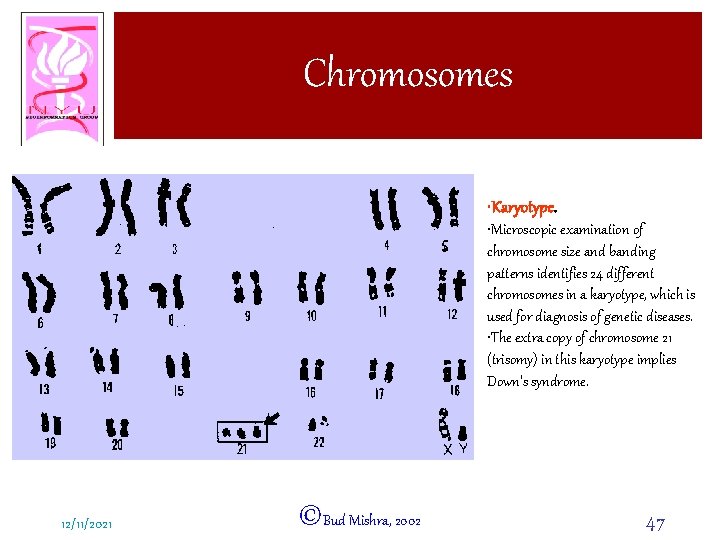 Chromosomes • Karyotype. • Microscopic examination of chromosome size and banding patterns identifies 24