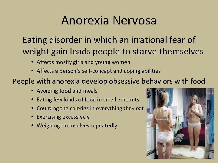 Anorexia Nervosa Eating disorder in which an irrational fear of weight gain leads people
