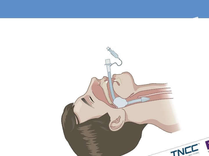 Ret c i t t o l g o r y a w Air