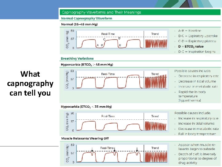 What capnography can tell you 