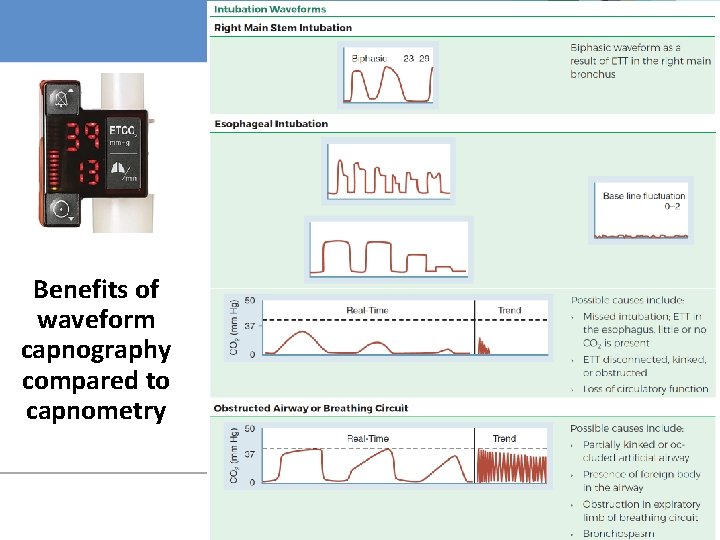 Benefits of waveform capnography compared to capnometry 