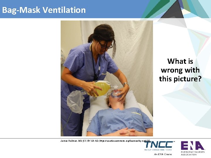 Bag-Mask Ventilation What is wrong with this picture? James Heilman, MD [CC BY-SA 4.