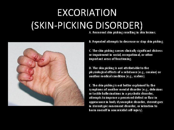 EXCORIATION (SKIN-PICKING DISORDER) A. Recurrent skin picking resulting in skin lesions. B. Repeated attempts