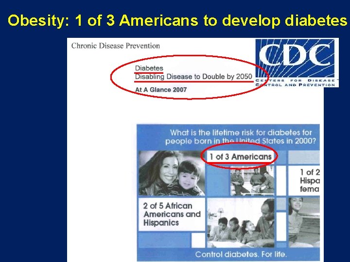 Obesity: 1 of 3 Americans to develop diabetes 