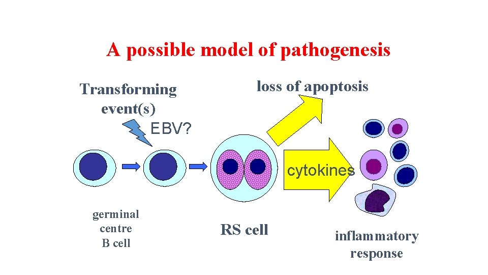 A possible model of pathogenesis Transforming event(s) EBV? loss of apoptosis cytokines germinal centre