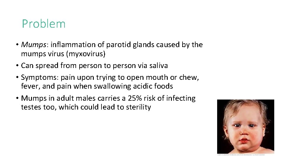 Problem • Mumps: inflammation of parotid glands caused by the mumps virus (myxovirus) •