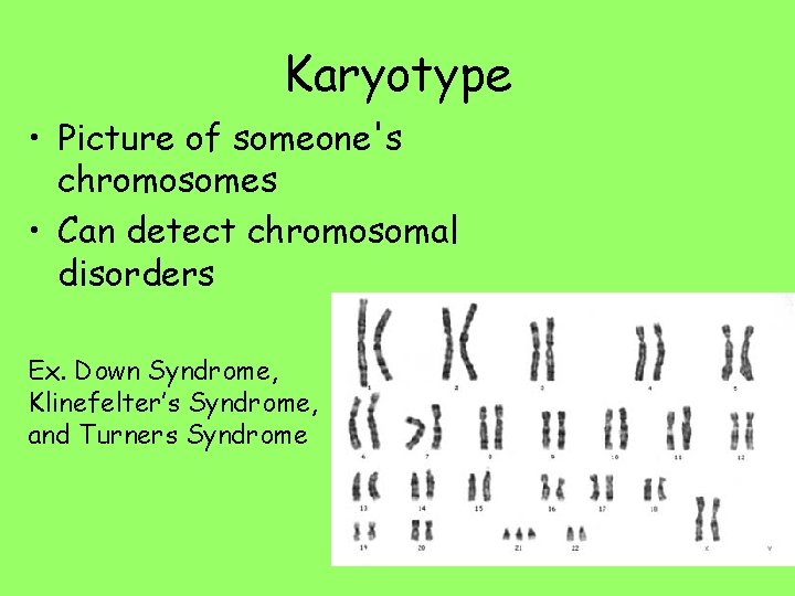 Karyotype • Picture of someone's chromosomes • Can detect chromosomal disorders Ex. Down Syndrome,
