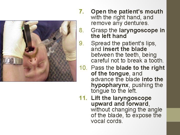 7. Open the patient's mouth with the right hand, and remove any dentures. 8.