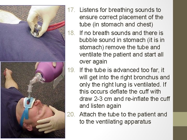 17. Listens for breathing sounds to ensure correct placement of the tube (in stomach