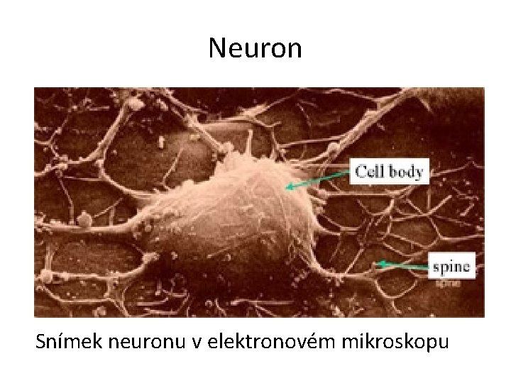 Neuron Snímek neuronu v elektronovém mikroskopu 