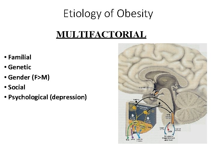Etiology of Obesity MULTIFACTORIAL • Familial • Genetic • Gender (F>M) • Social •