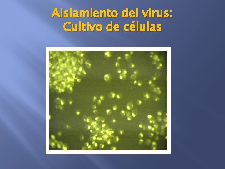 Aislamiento del virus: Cultivo de células 