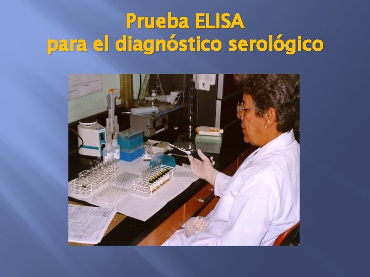 Prueba ELISA para el diagnóstico serológico 