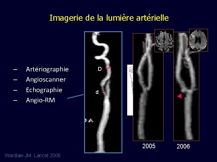 Imagerie de la lumière artérielle – – Artériographie Angioscanner Echographie Angio-RM D d 2005
