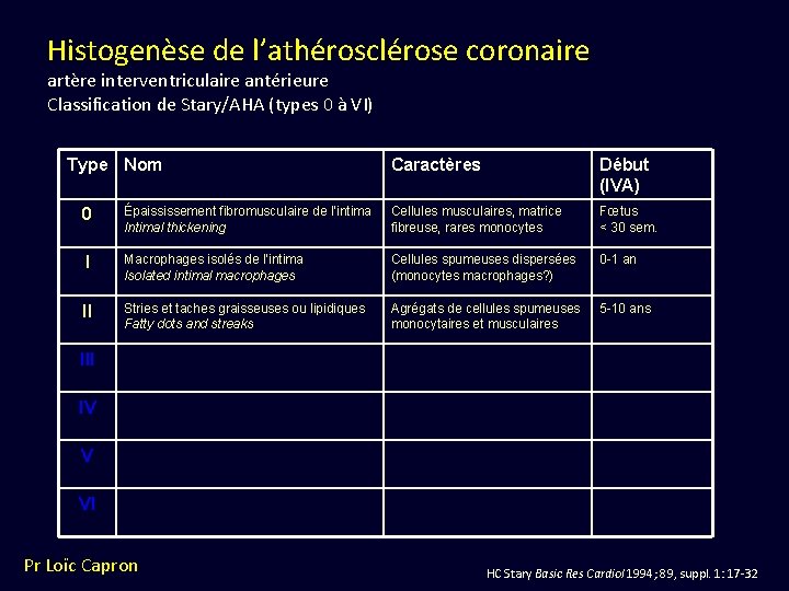 Histogenèse de l’athérosclérose coronaire artère interventriculaire antérieure Classification de Stary/AHA (types 0 à VI)